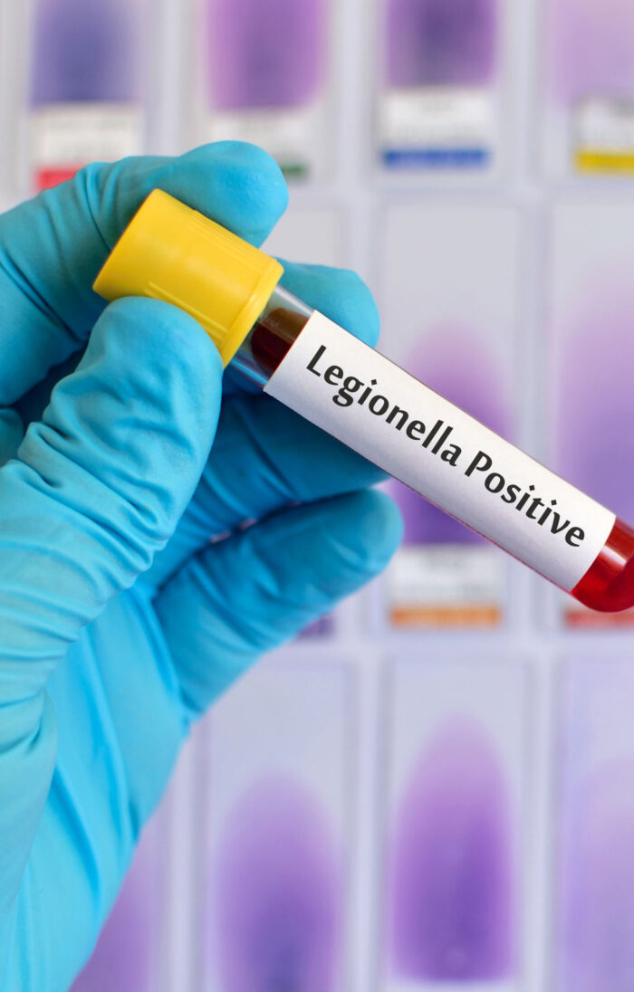 analisis legionella madrid